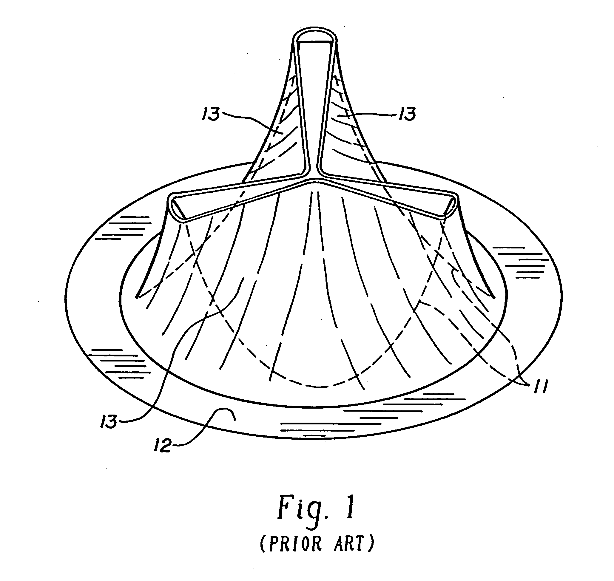 Bioprosthetic cardiovascular valve system