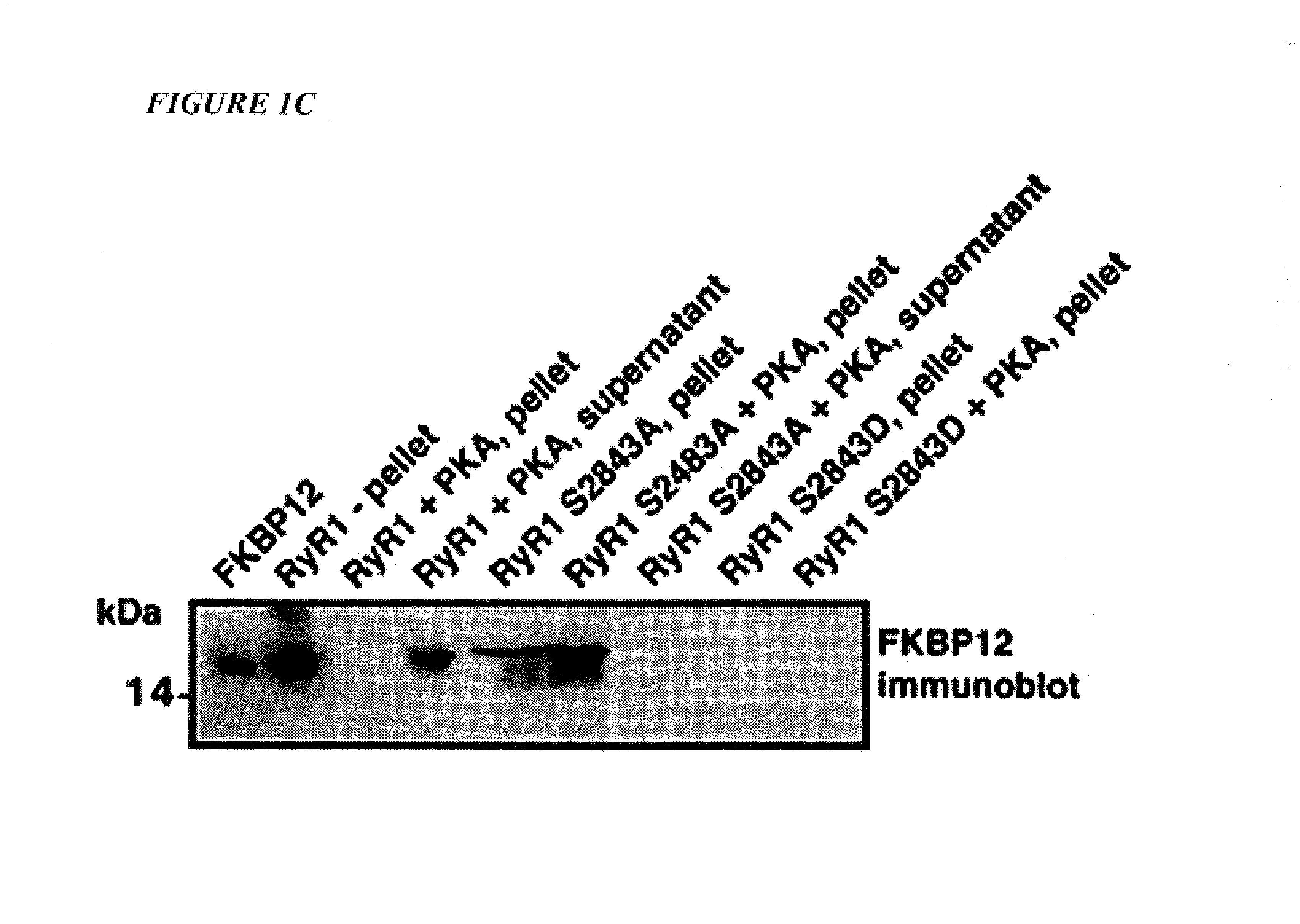 Type 1 ryanodine receptor-based methods