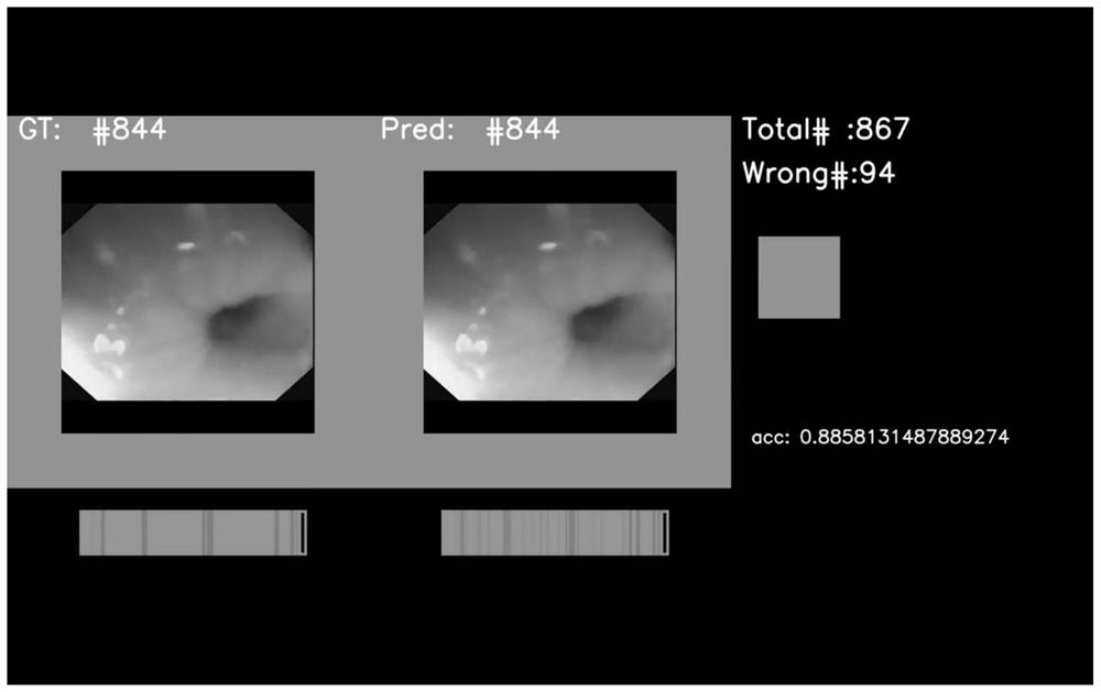 Esophageal endoscope video frame sequence quality classification algorithm using space-time information of adjacent frames