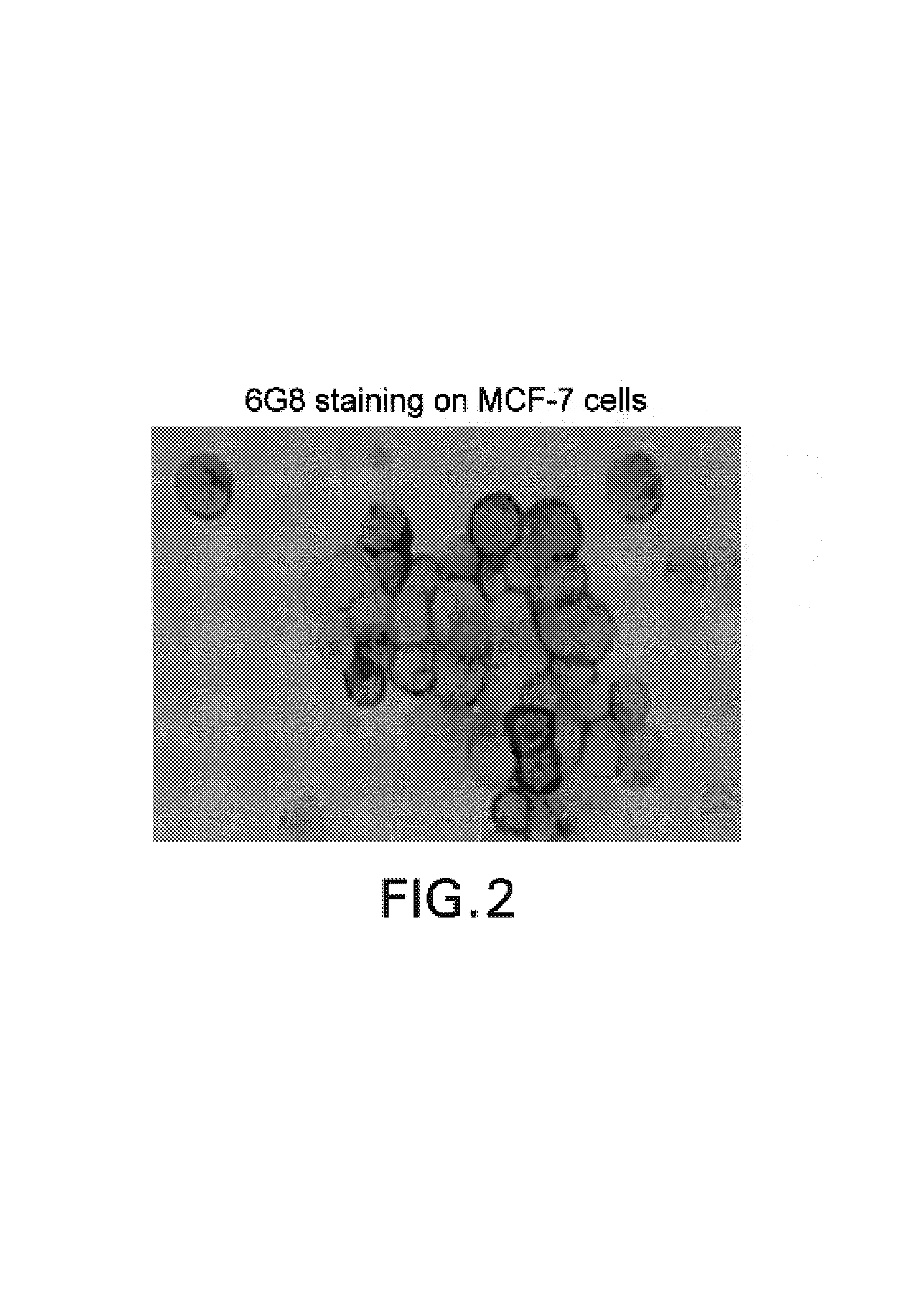 Autocrine growth factor receptor antibodies and methods