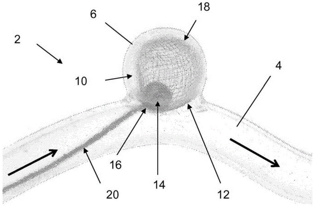 Two-Stage Deployment Aneurysm Embolization Device