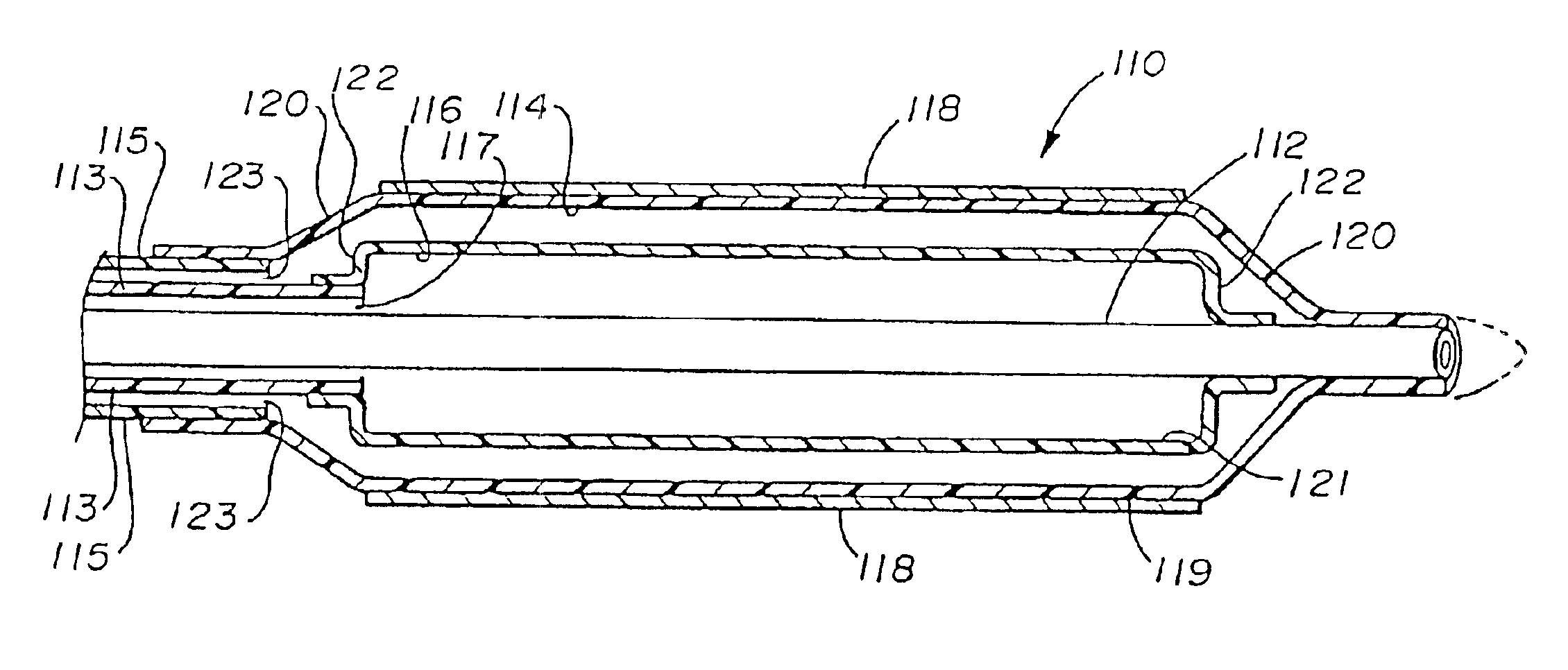 Balloon catheter with stent securement means