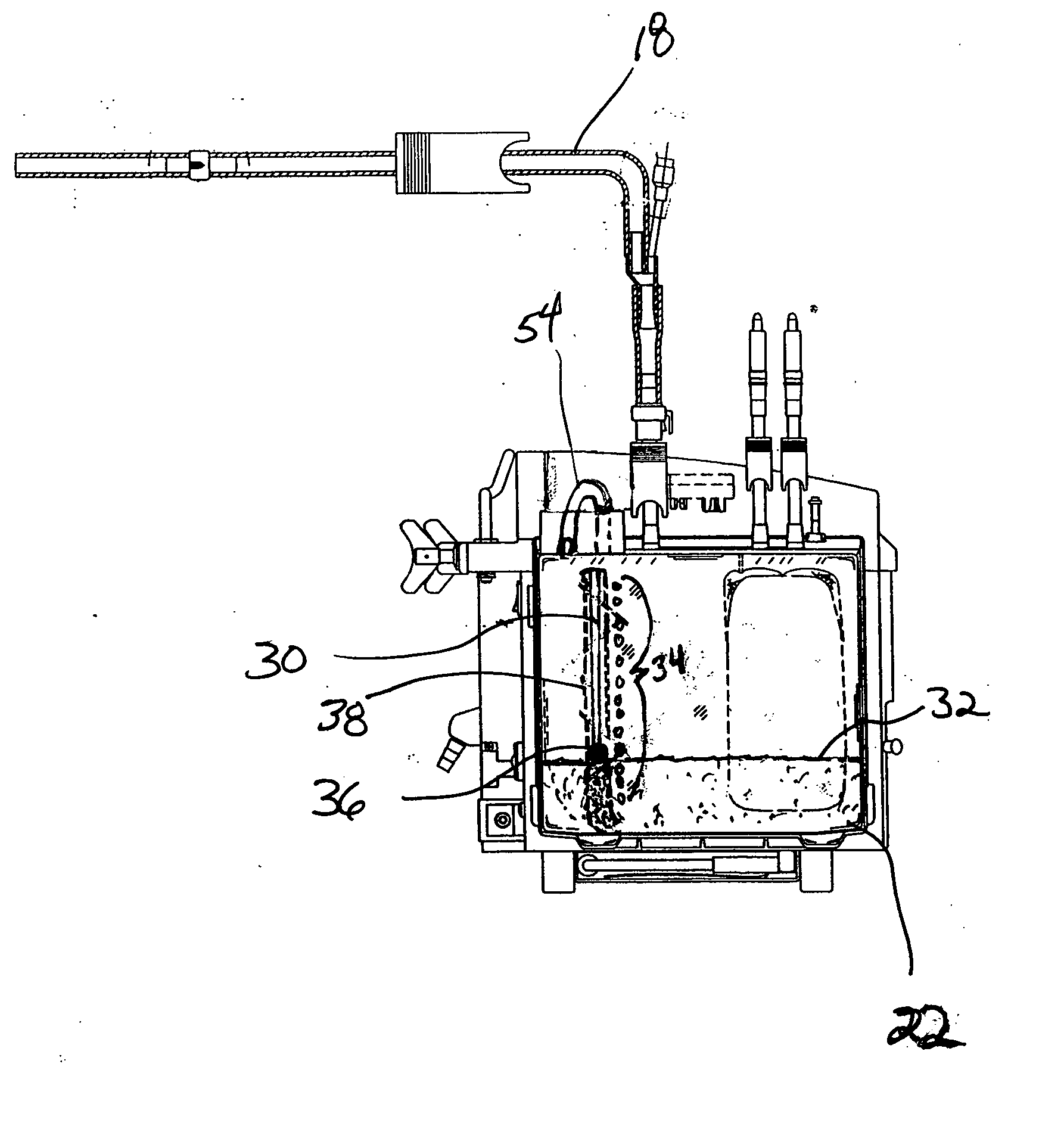 Postoperative fluid monitoring and alert system