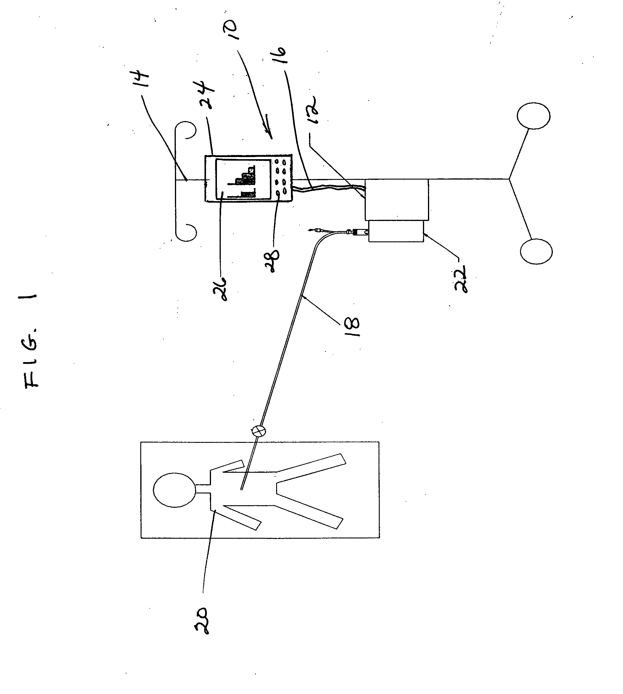 Postoperative fluid monitoring and alert system