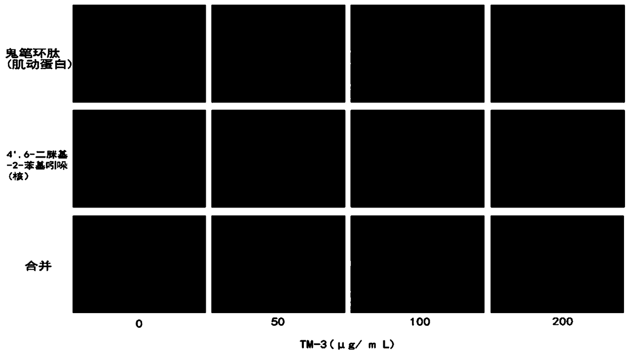 Composition for prevention and treatment of osteoporosis comprising the extract of medicinal herb mixture