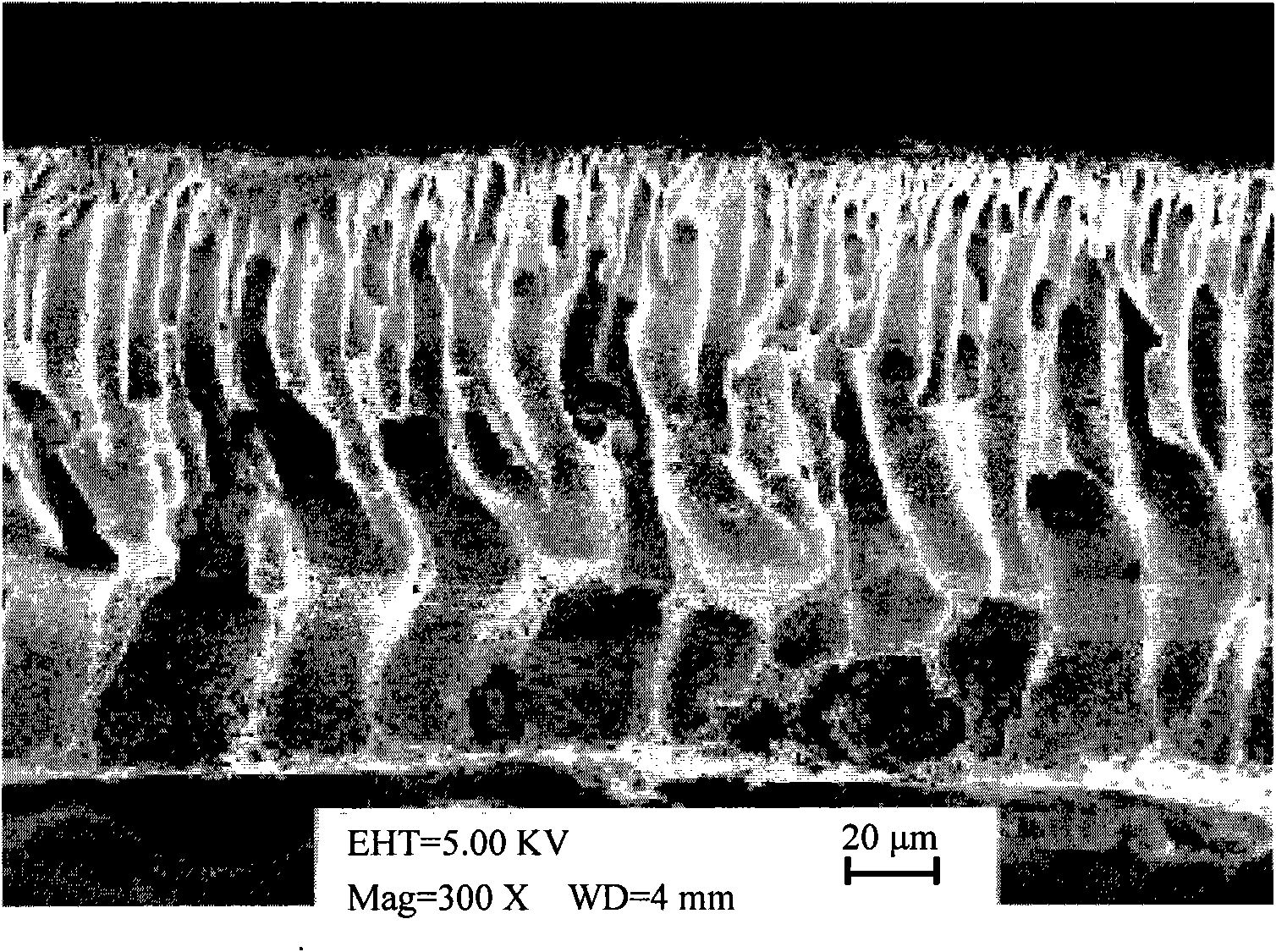 Graft-modified macromolecular filter membrane for water treatment and method for preparing same