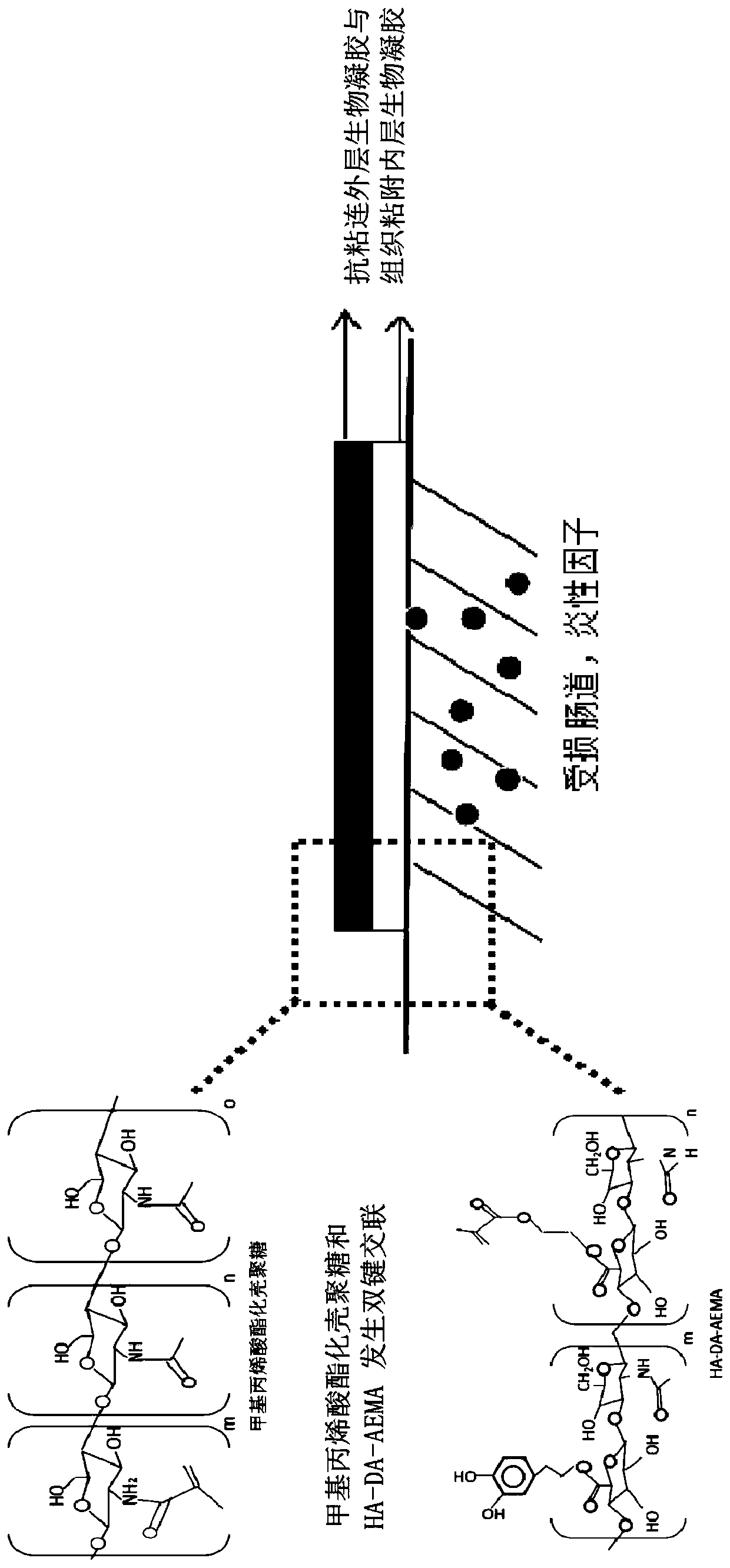 Preparation method of anti-intestinal-adhesion double-layer biogel and double-layer biogel