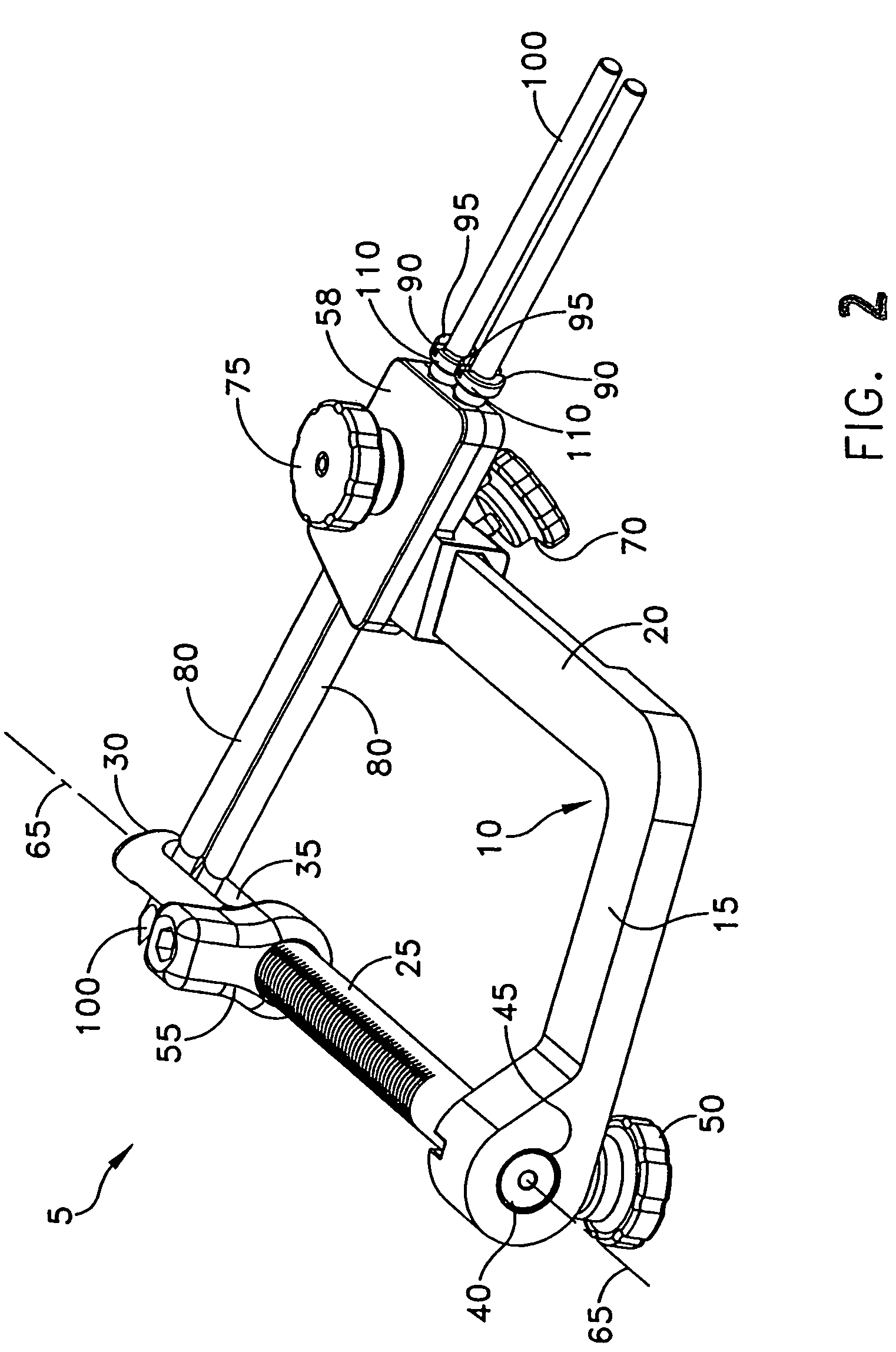 Method and apparatus for fixing a graft in a bone tunnel