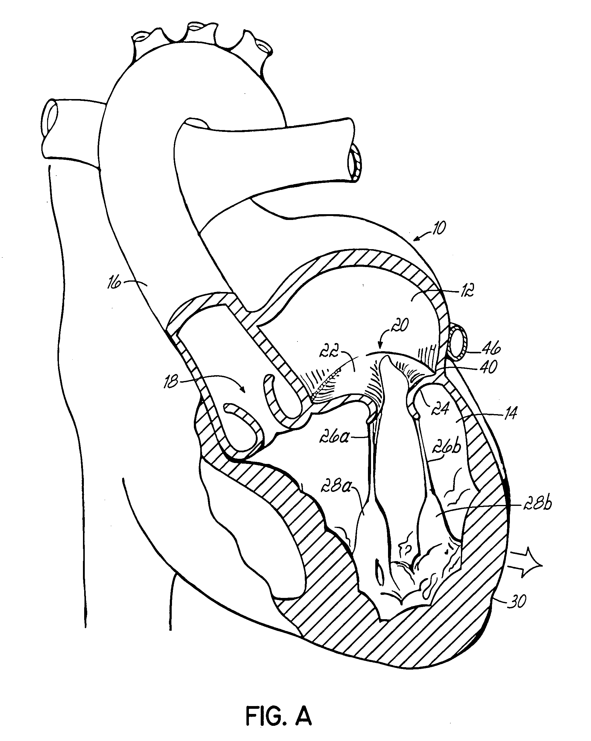 Tissue fastening systems and methods utilizing magnetic guidance