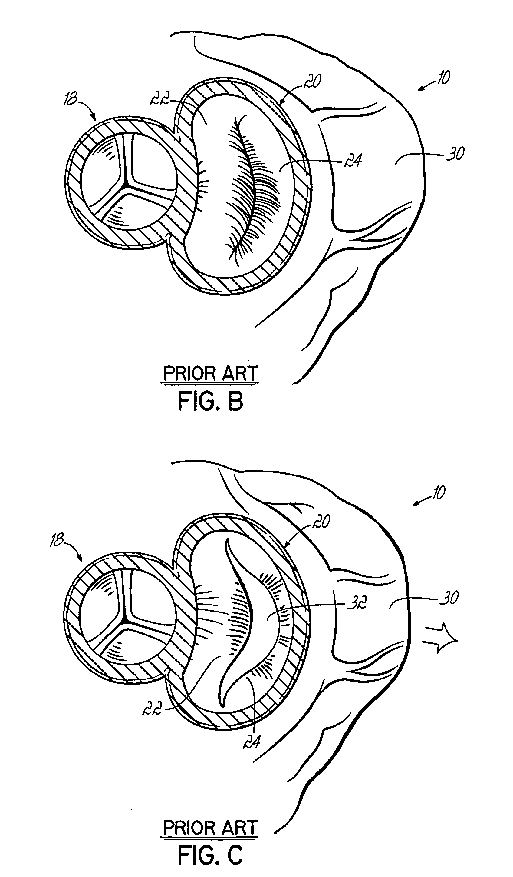 Tissue fastening systems and methods utilizing magnetic guidance