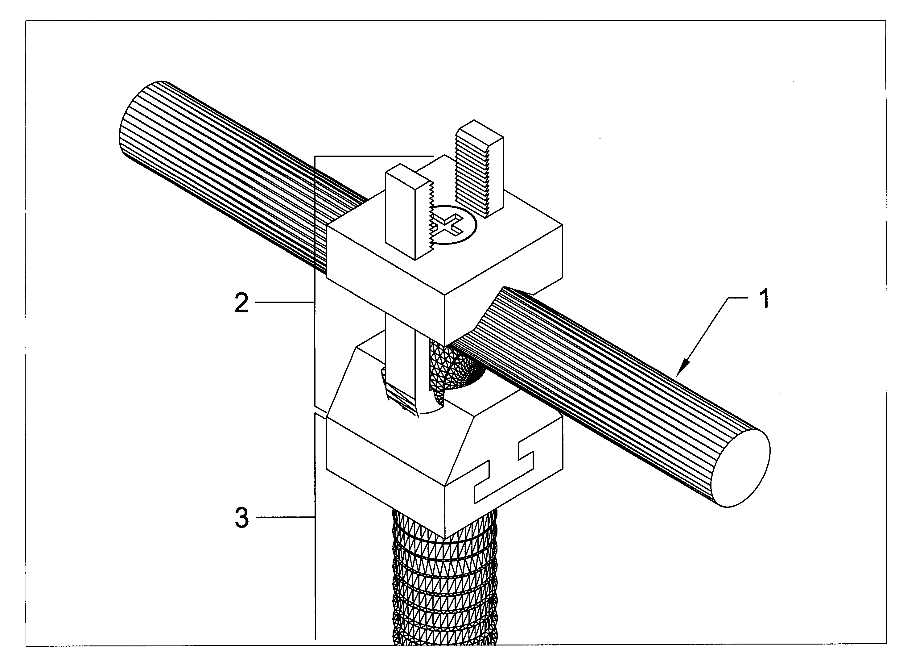 Tension fixation system