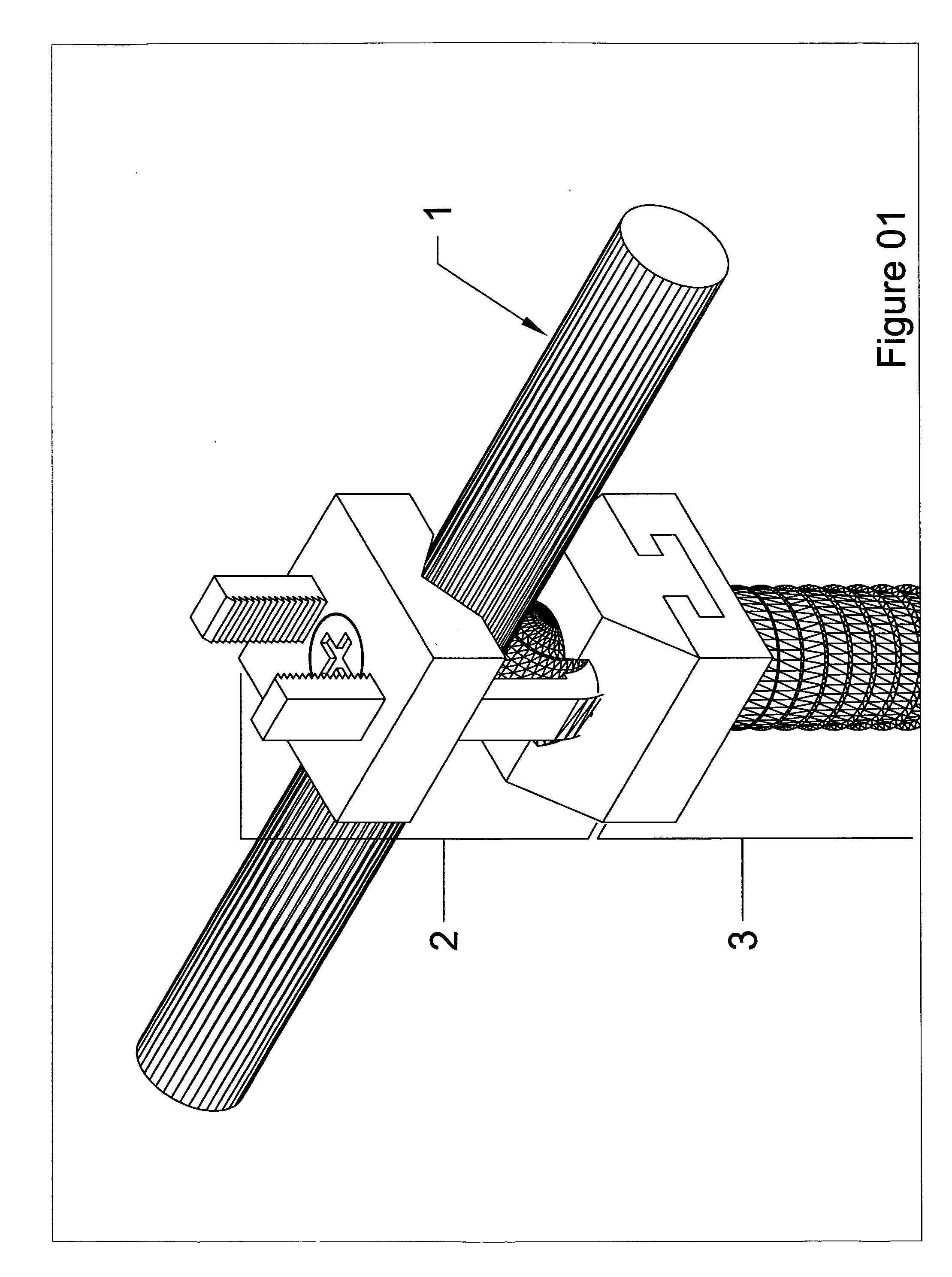 Tension fixation system