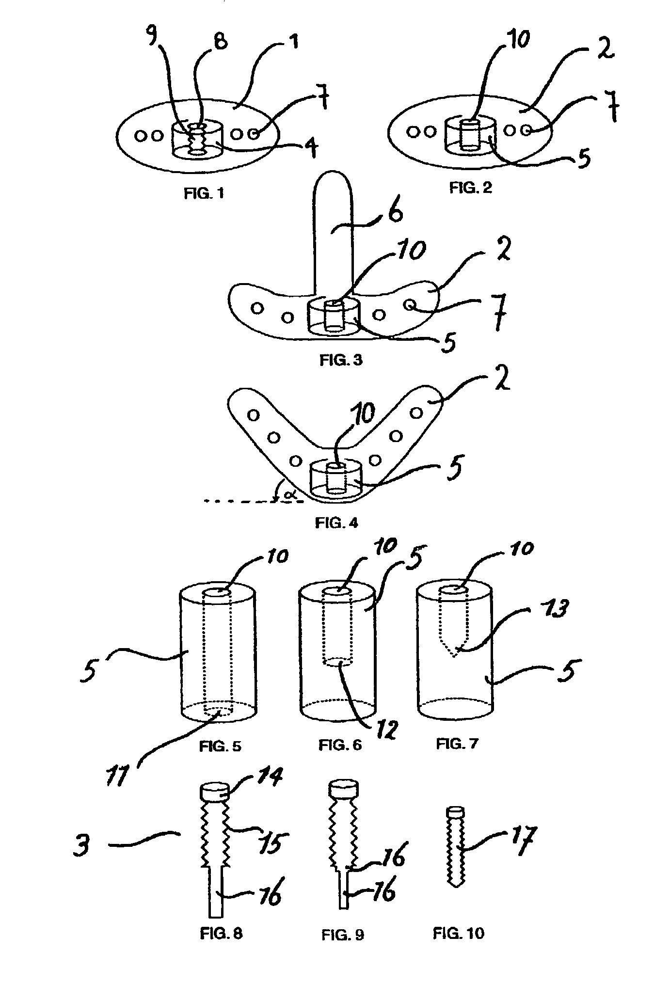 Distraction device for maxillofacial surgery