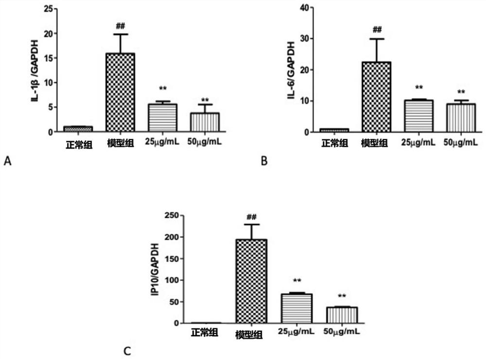 Application of Luofushan Baicao oil in preparation of medicine for preventing or treating respiratory system infectious diseases