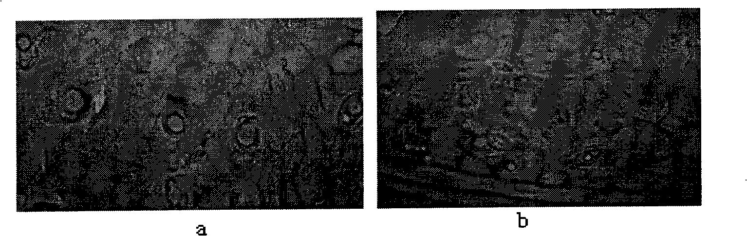 Sampling method for non-damage fixed position observation of plant stomata in field experiment