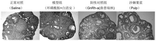 Application of plant fruit pulp in preparation of medicines and health-care foods for preventing ovarian injury caused by chemoradiotherapy