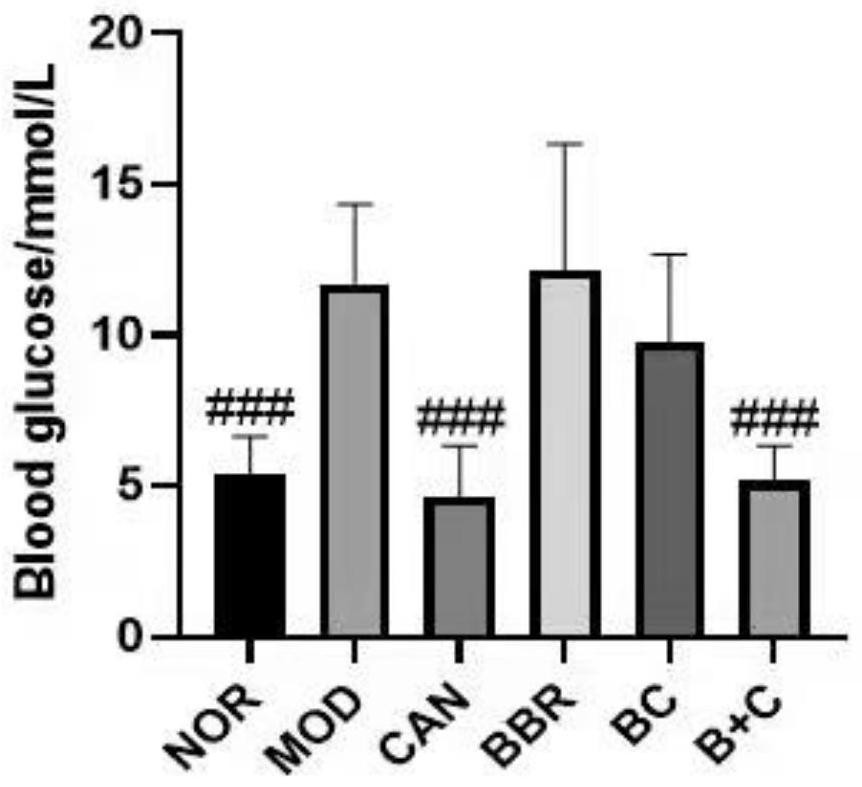 Berberine canagliflozin derivative as well as preparation method and application thereof