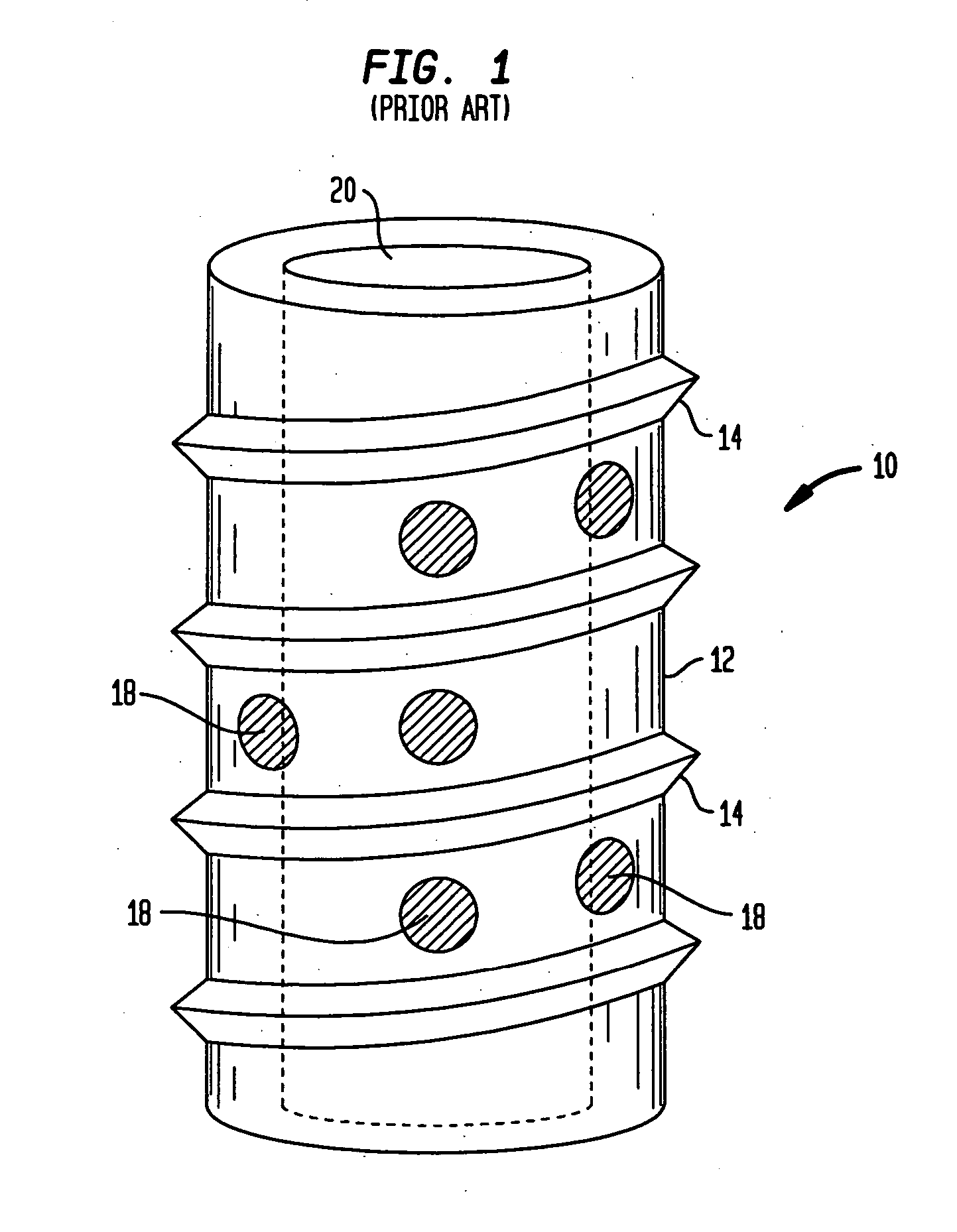 Artificial intervertebral disc having a slotted belleville washer force restoring element