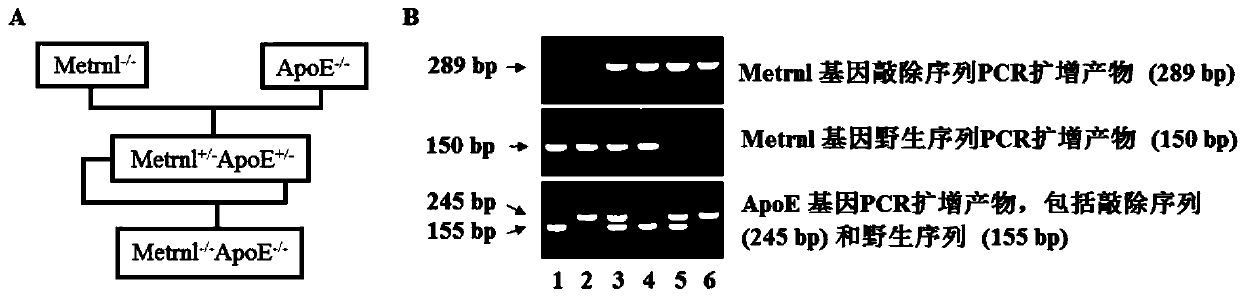 Application of Metrnl in atherosclerosis (AS) resistance