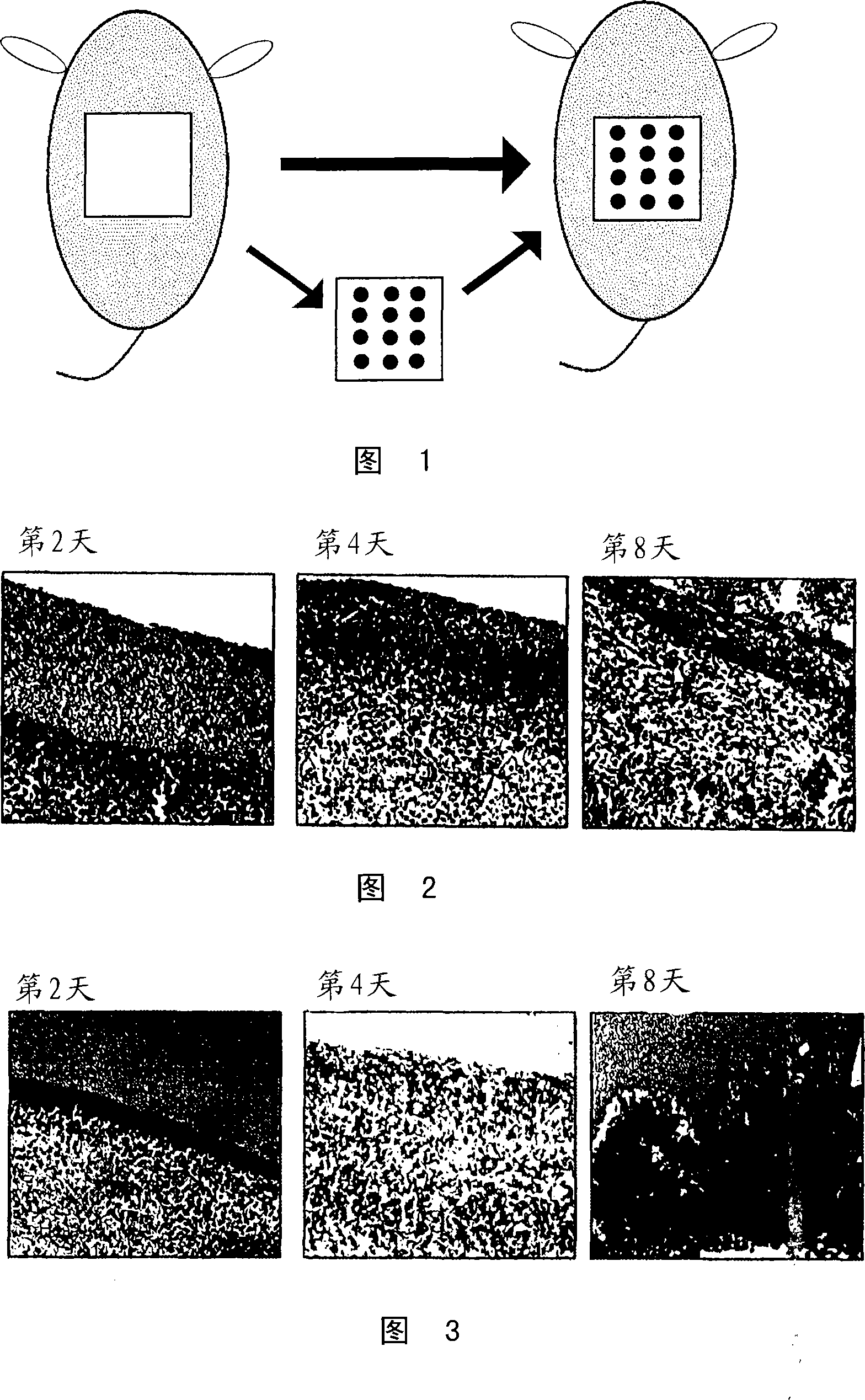 Medical composition for promotion of skin regeneration