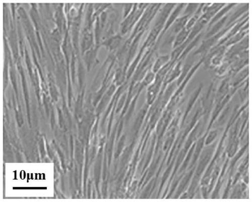 Method for inducing amniotic fluid mesenchymal stem cells to differentiate into cardiomyocytes in vitro