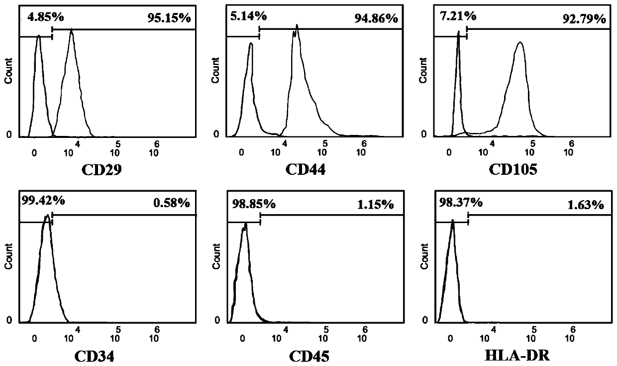 Method for inducing amniotic fluid mesenchymal stem cells to differentiate into cardiomyocytes in vitro