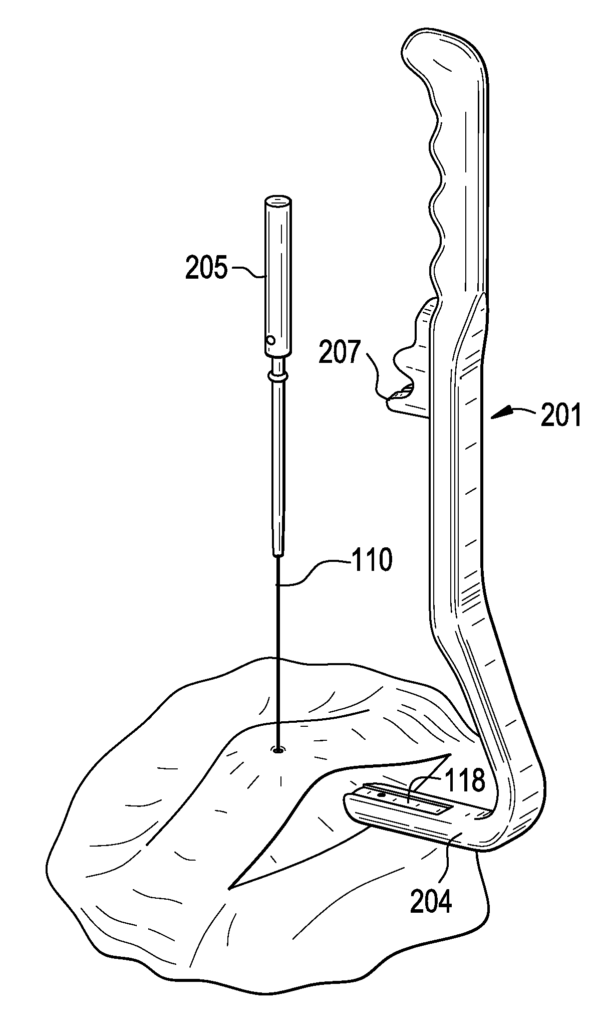 Method and Devices For A Sub-Splenius / Supra-Levator Scapulae Surgical Access Technique