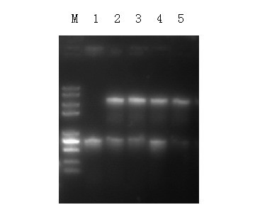 EPSP synthase gene rice chloroplast expression vector and application thereof