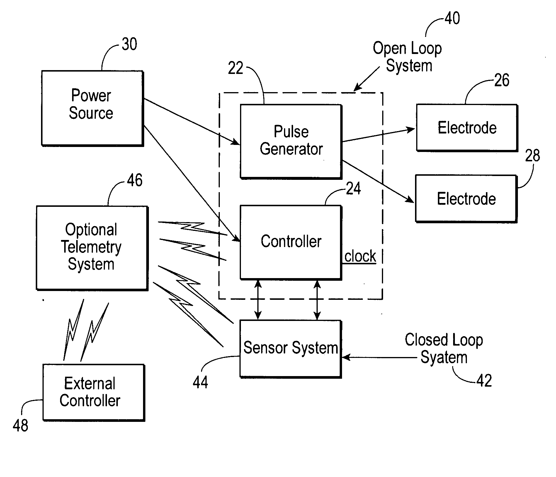 Gastrointestinal stimulator device for digestive and eating disorders