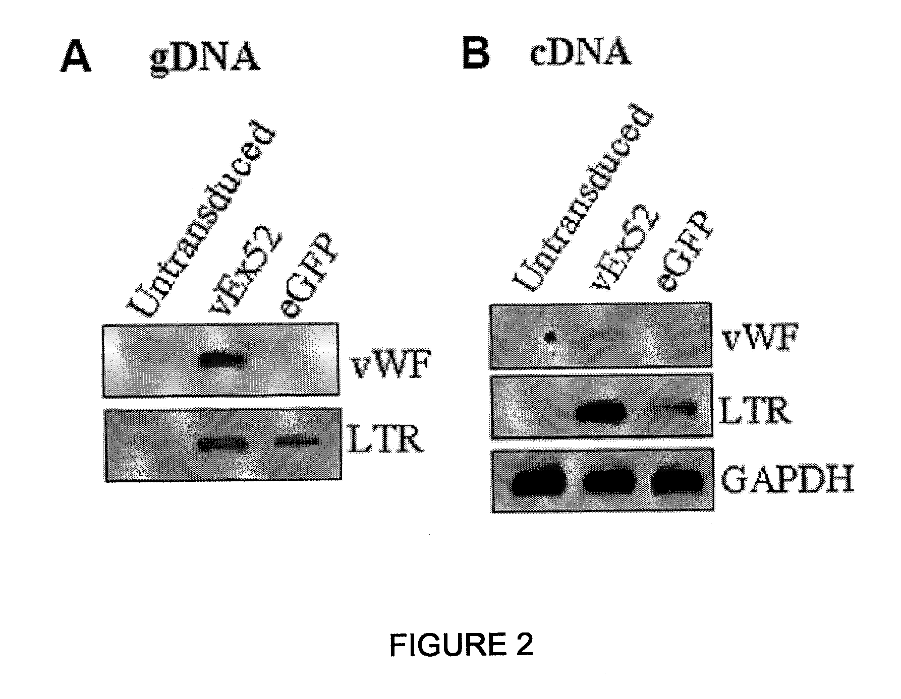 Recombinant expression vector system for variants of coagulation factor VIII and von Willebrand factor