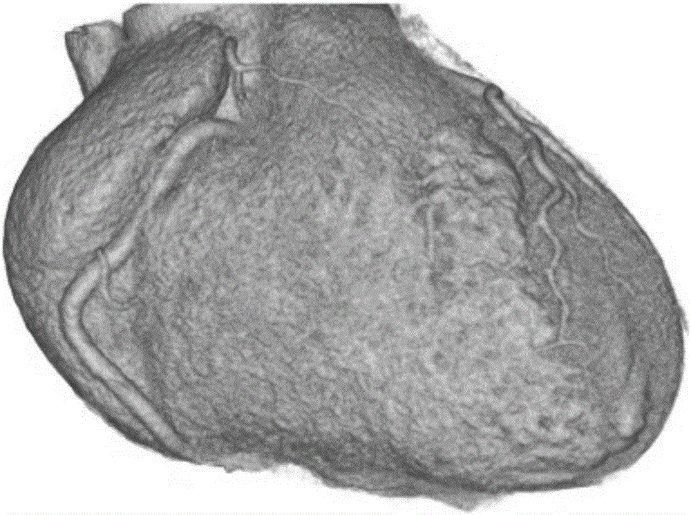 Full-automatic coronary artery segmentation method