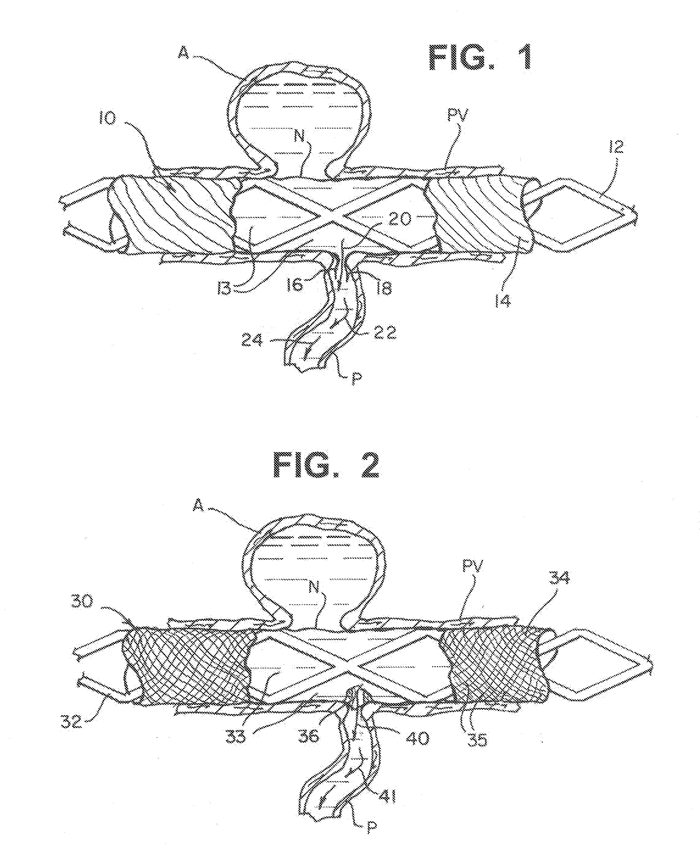 Modifiable occlusion device