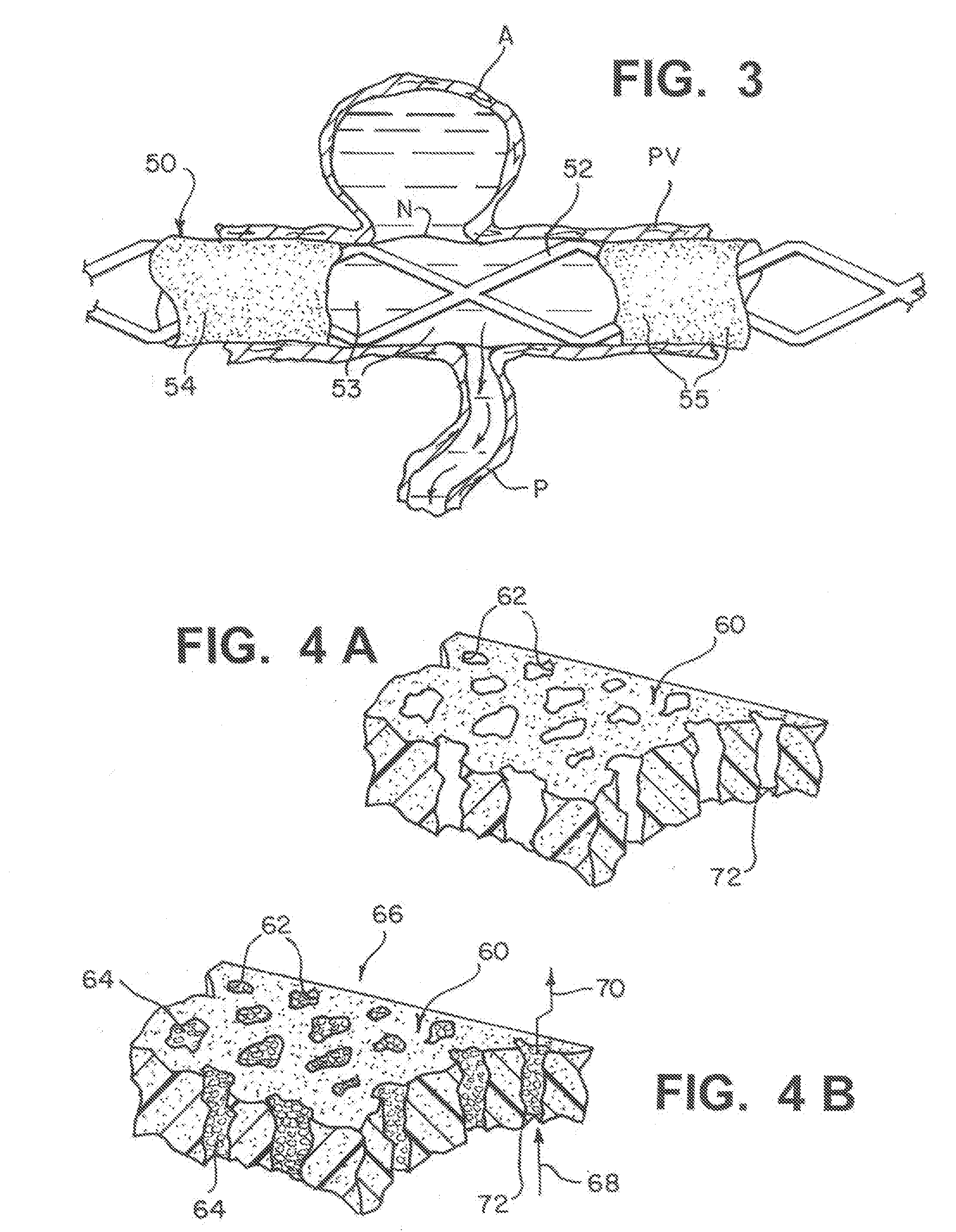 Modifiable occlusion device