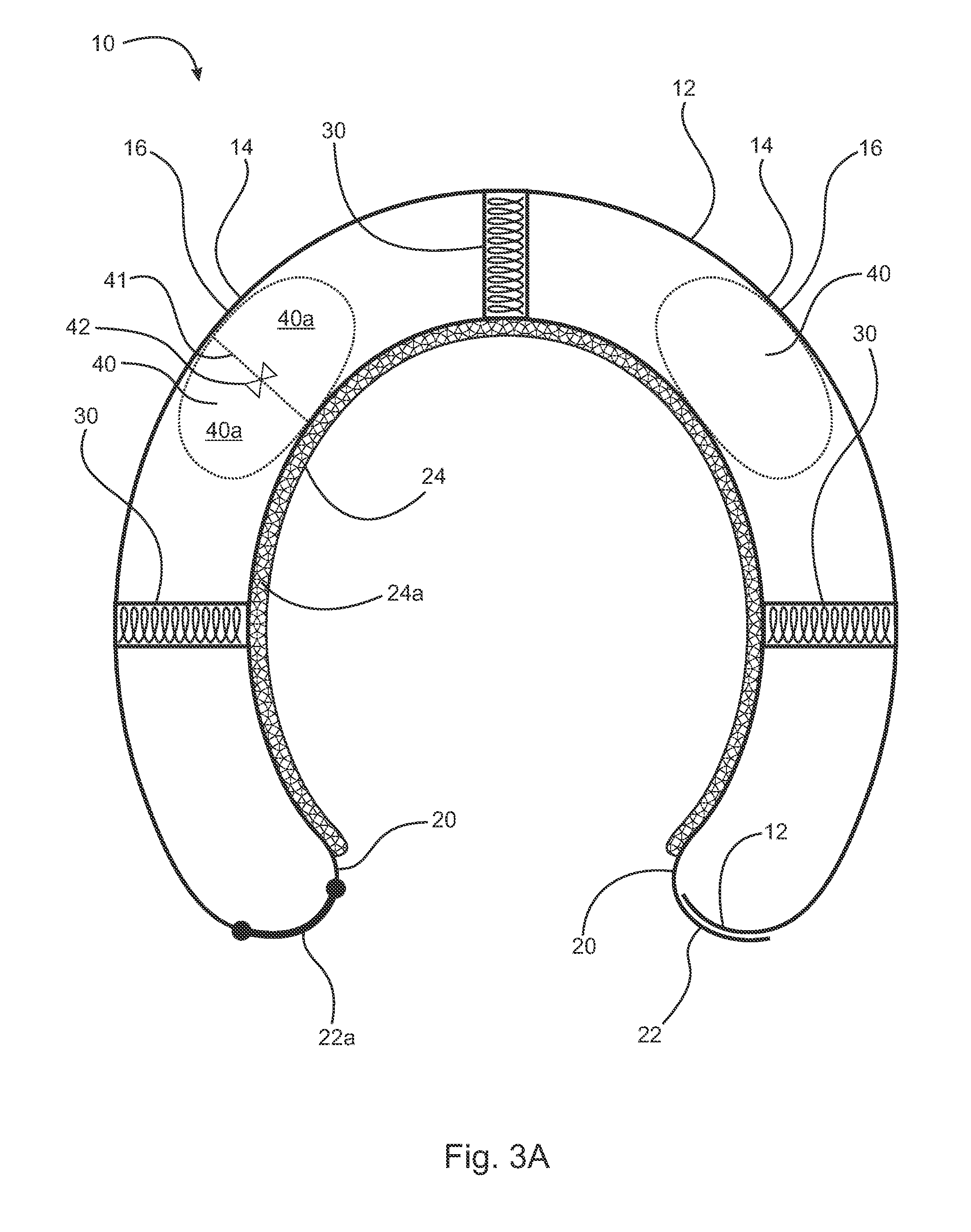 Helmet with multiple protective zones