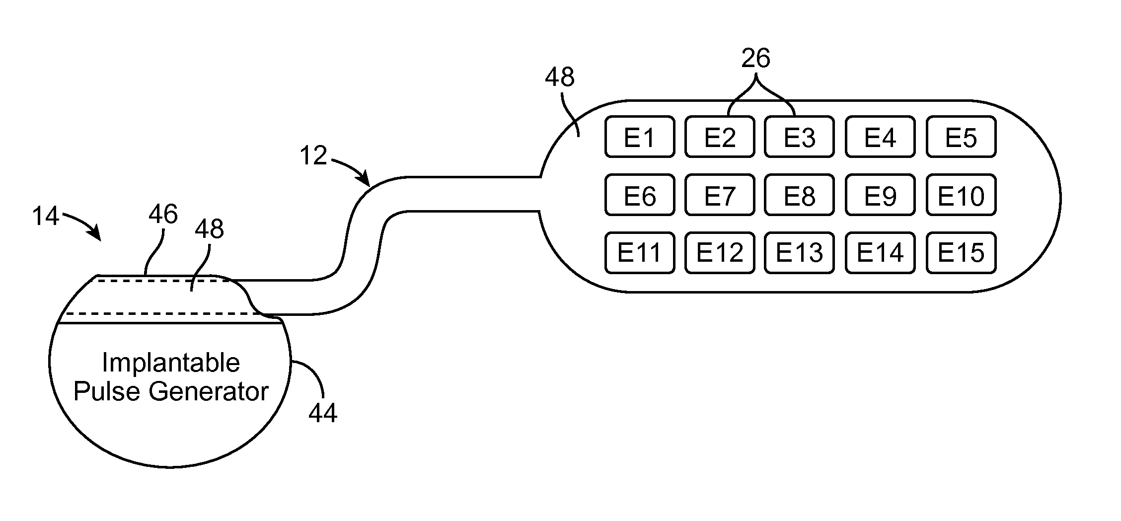 Method for epidural stimulation of neural structures