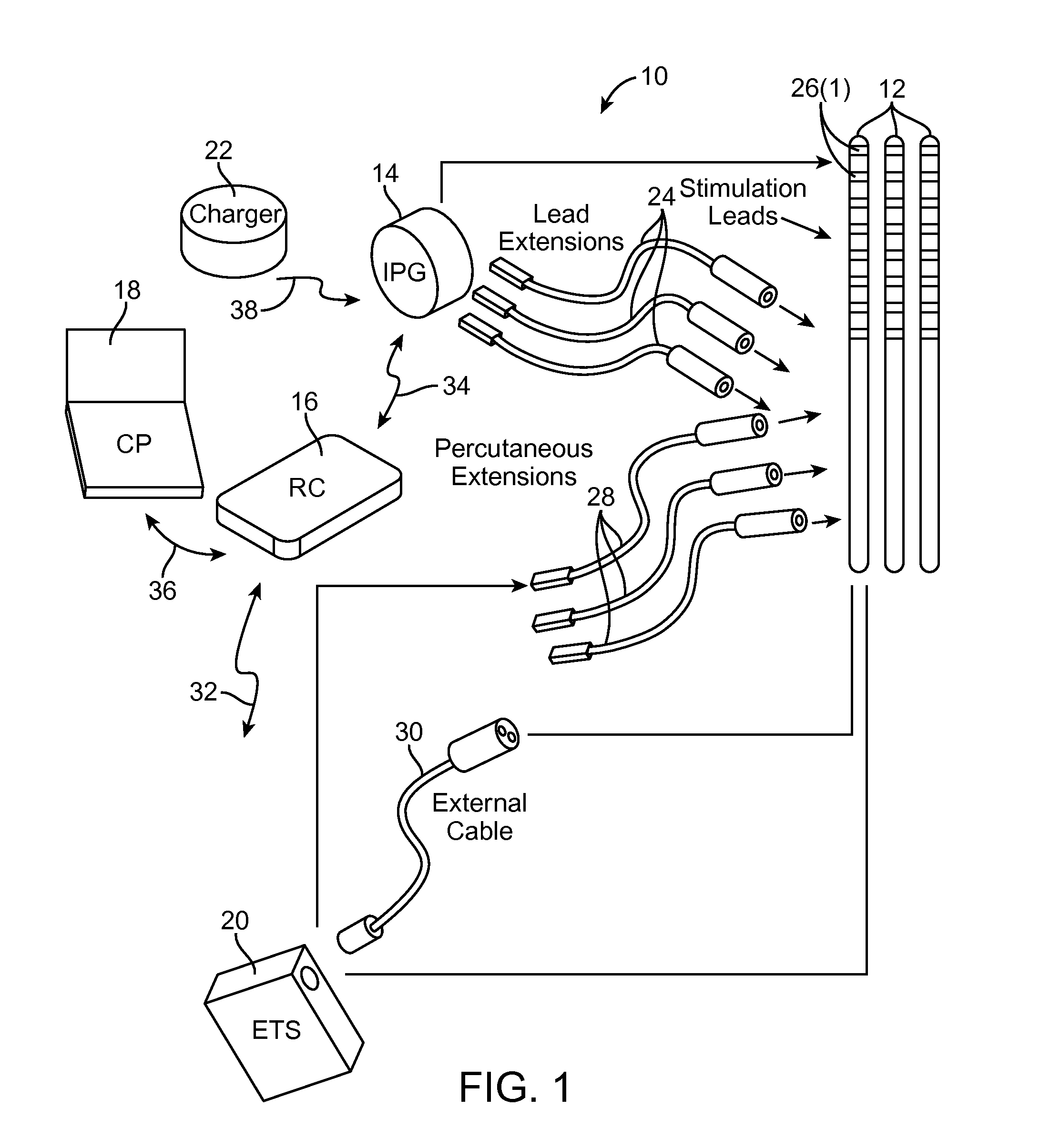 Method for epidural stimulation of neural structures