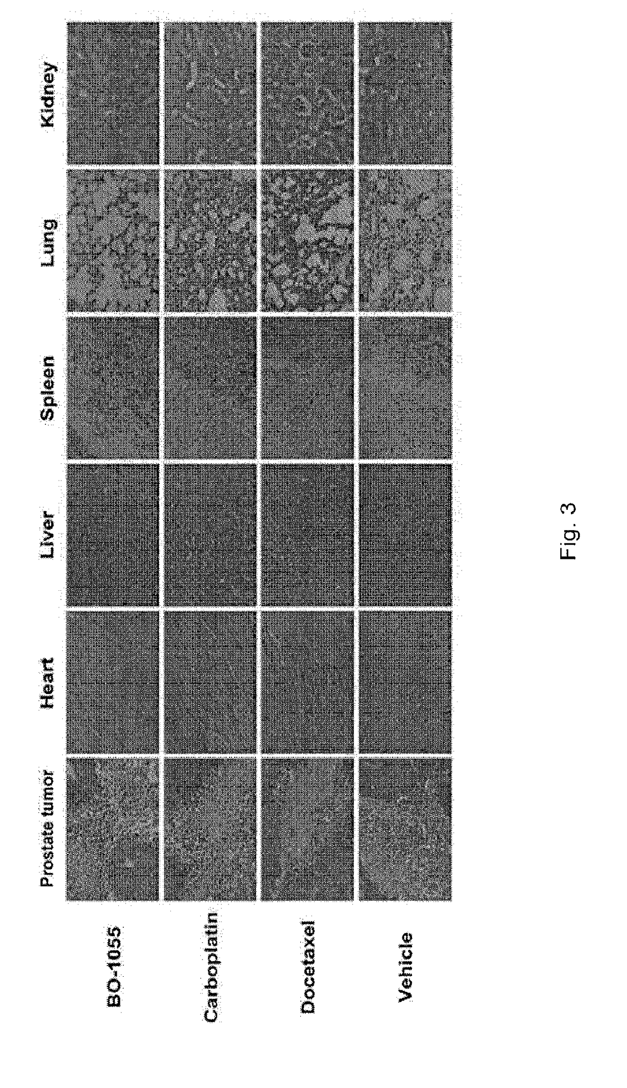 Use of Ureidomustine (BO-1055) in Cancer Treatment