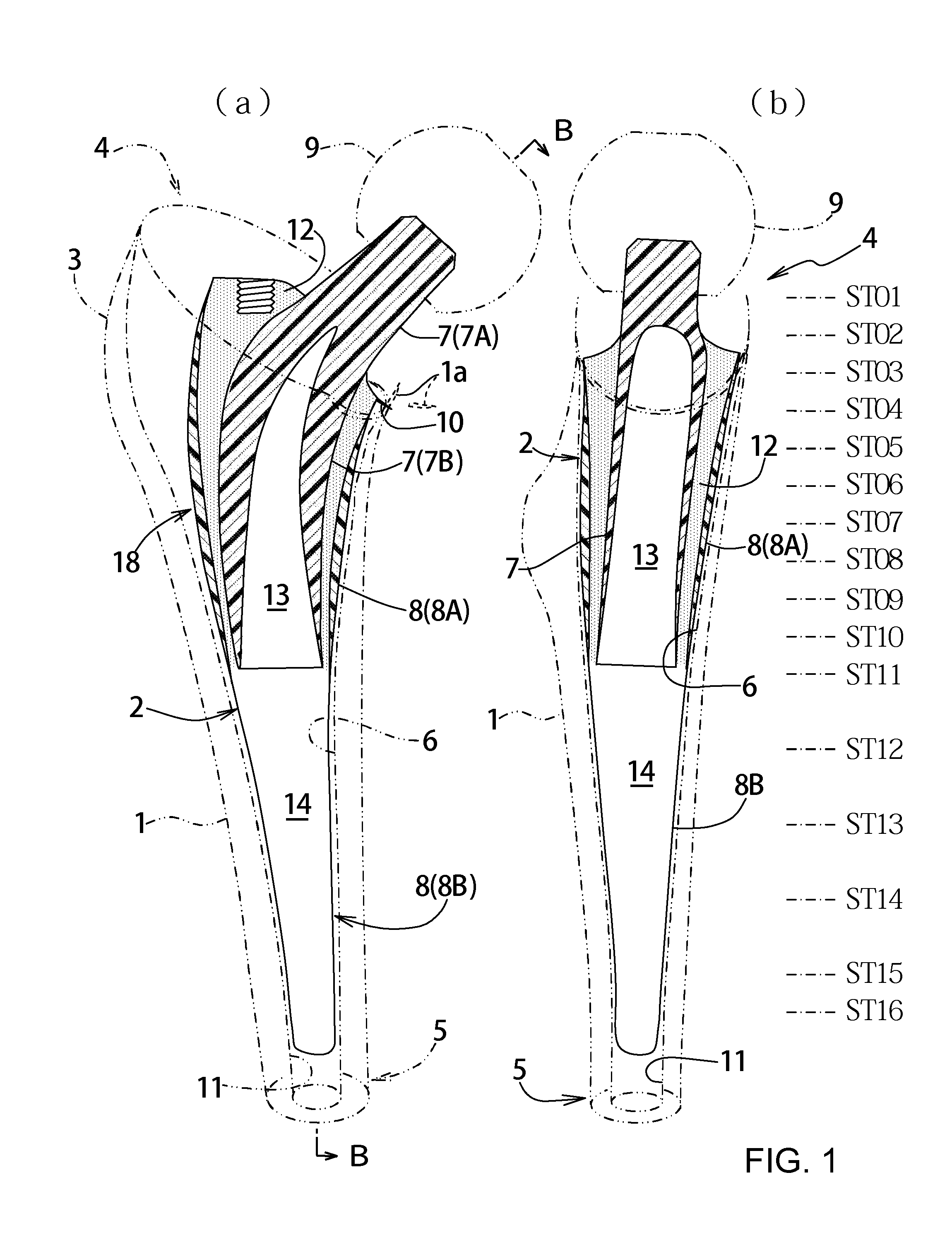 Artificial cementless hip prosthesis stem