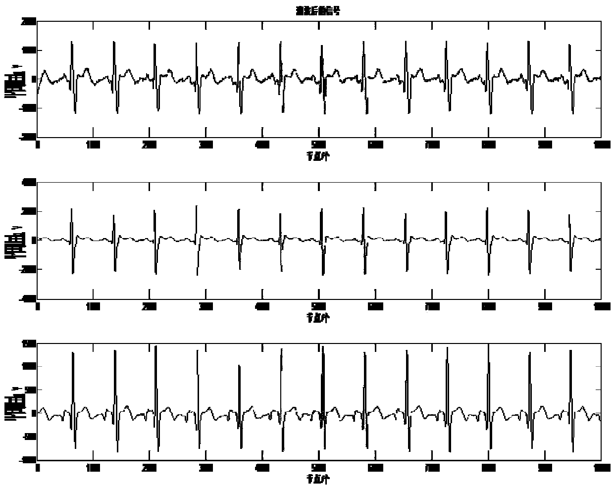 P wave extracting method based on orthogonal projection and independent component analysis