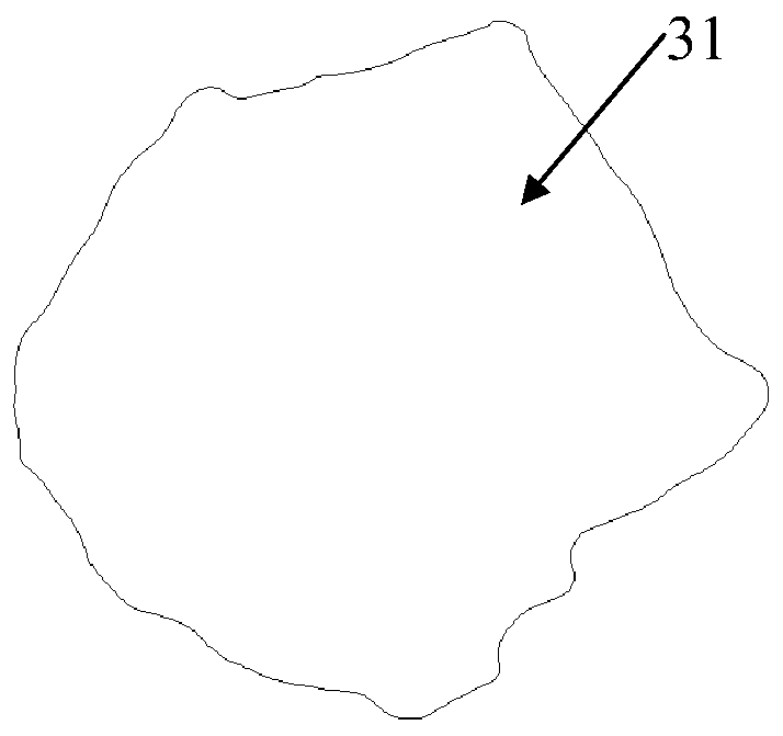 Mineralized collagen-based skull defect restoration based on digital reconstruction and its preparation method