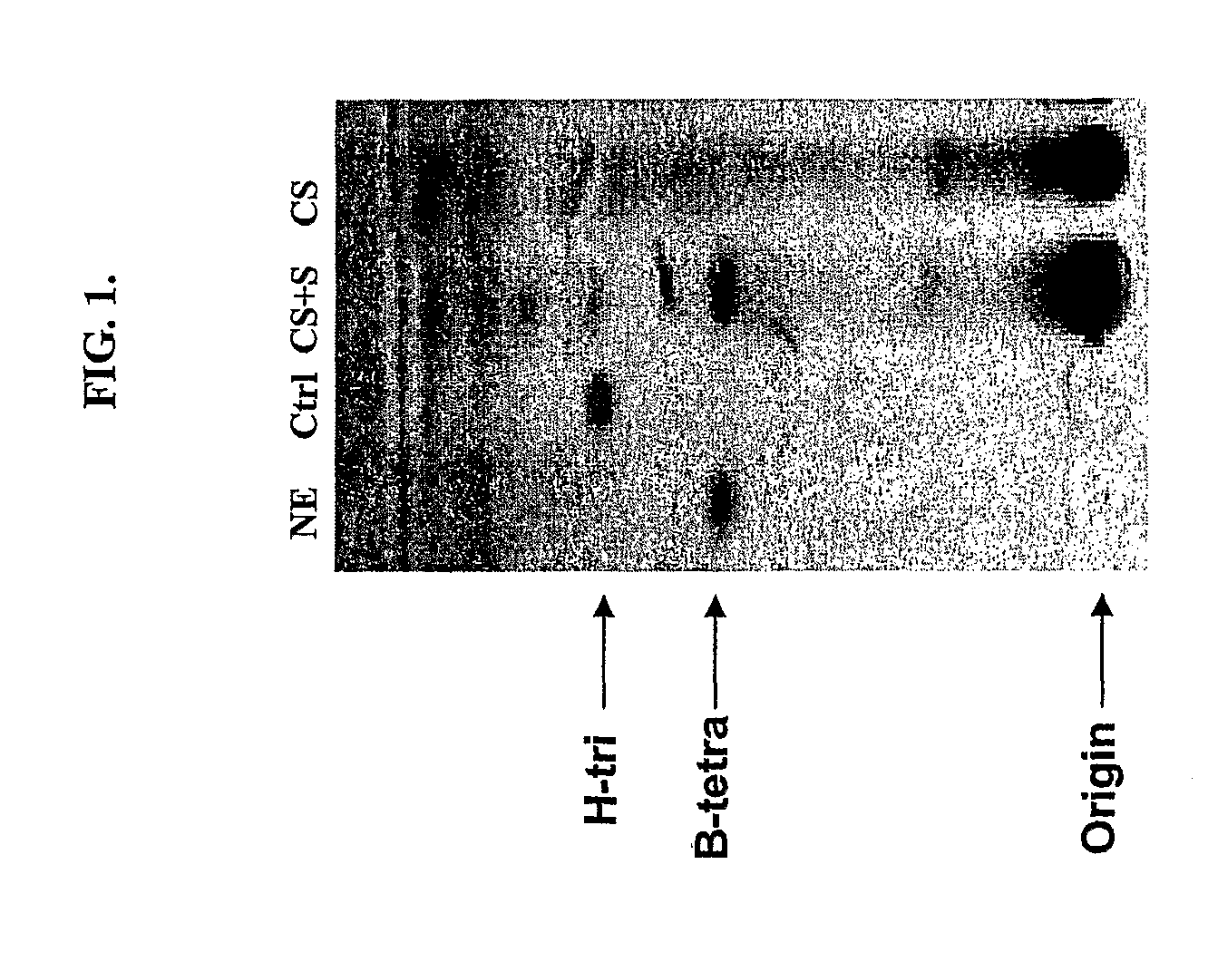 Method of preparing non-human tissues for xenotransplantation using α-galactosidase