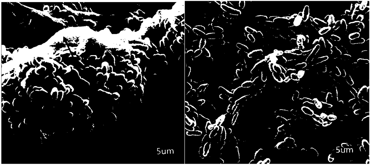 CRISPR-B (Clustered Regularly Interspaced Short Palindromic Repeats-B) gene editing method for gtfB site of specific targeting streptococcus mutans and application