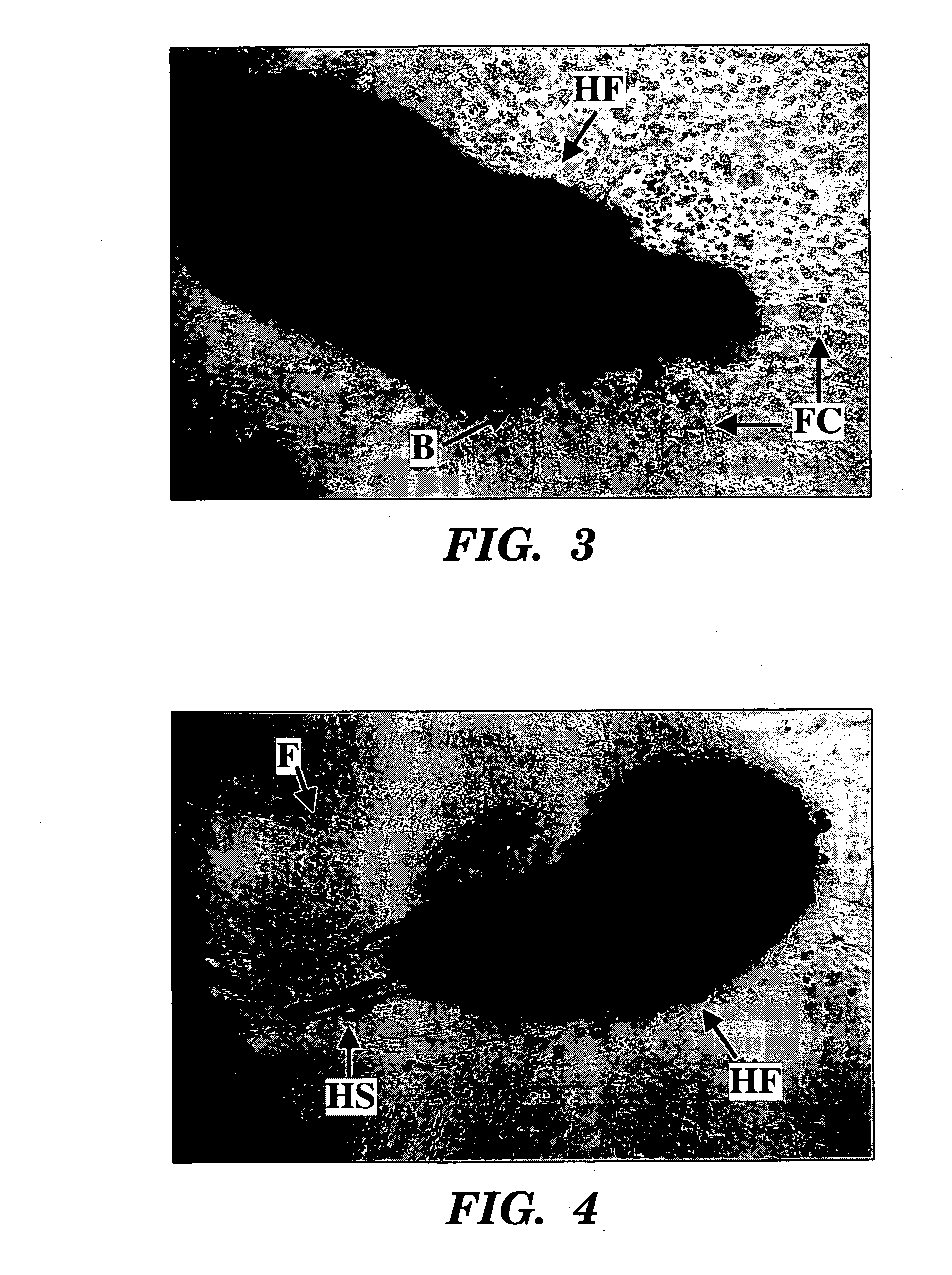 Methods for ex vivo propagation of somatic hair follicle stem cells