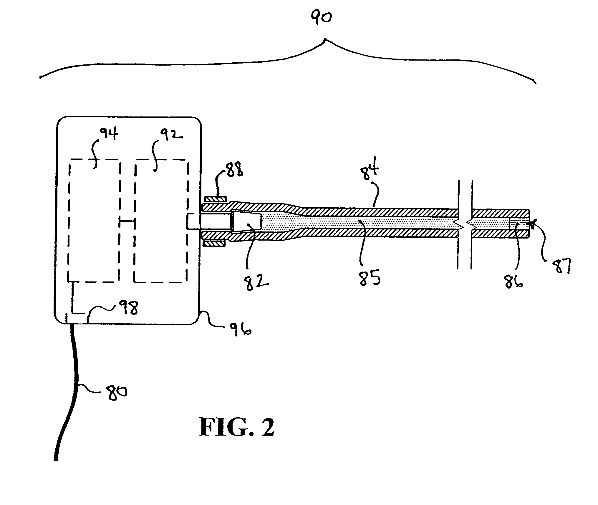 Feedback control and ventricular assist devices