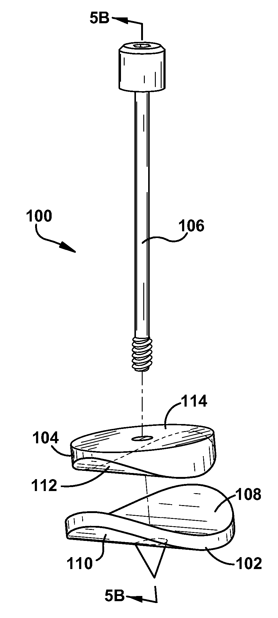 Orthopedic fixation mechanism