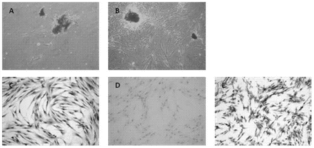 A preparation for treating periodontitis with a combination of effective parts of Scutellaria baicalensis and Rhizoma Drynariae