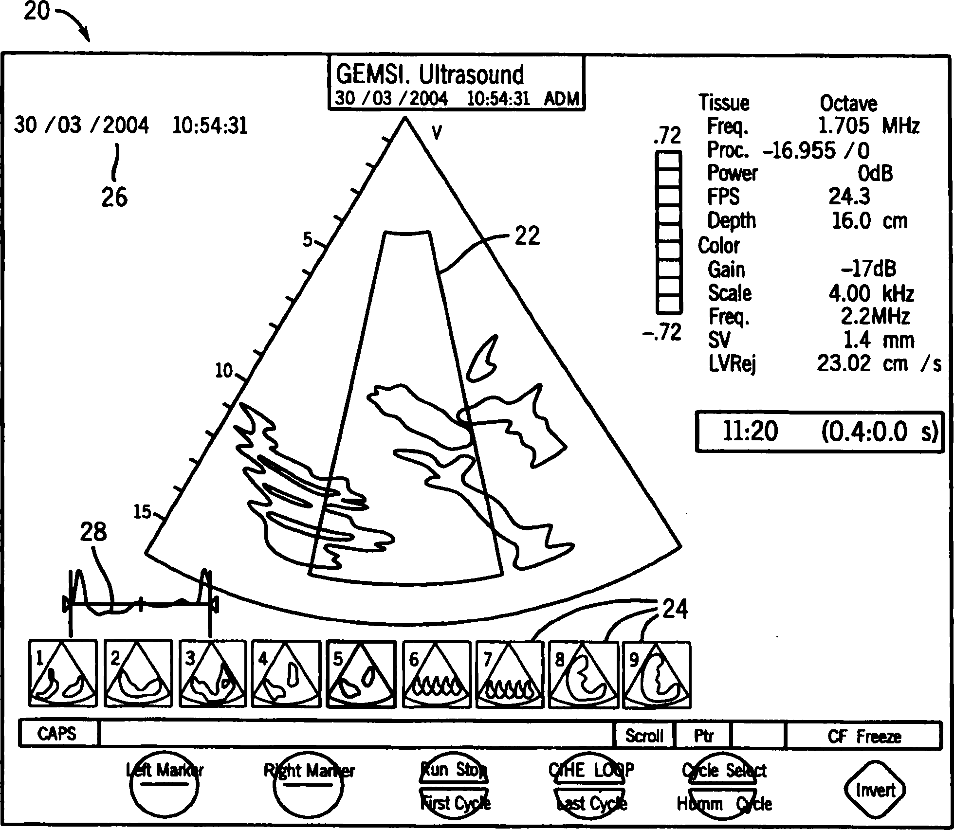 Integrated anesthesia monitoring and ultrasound display