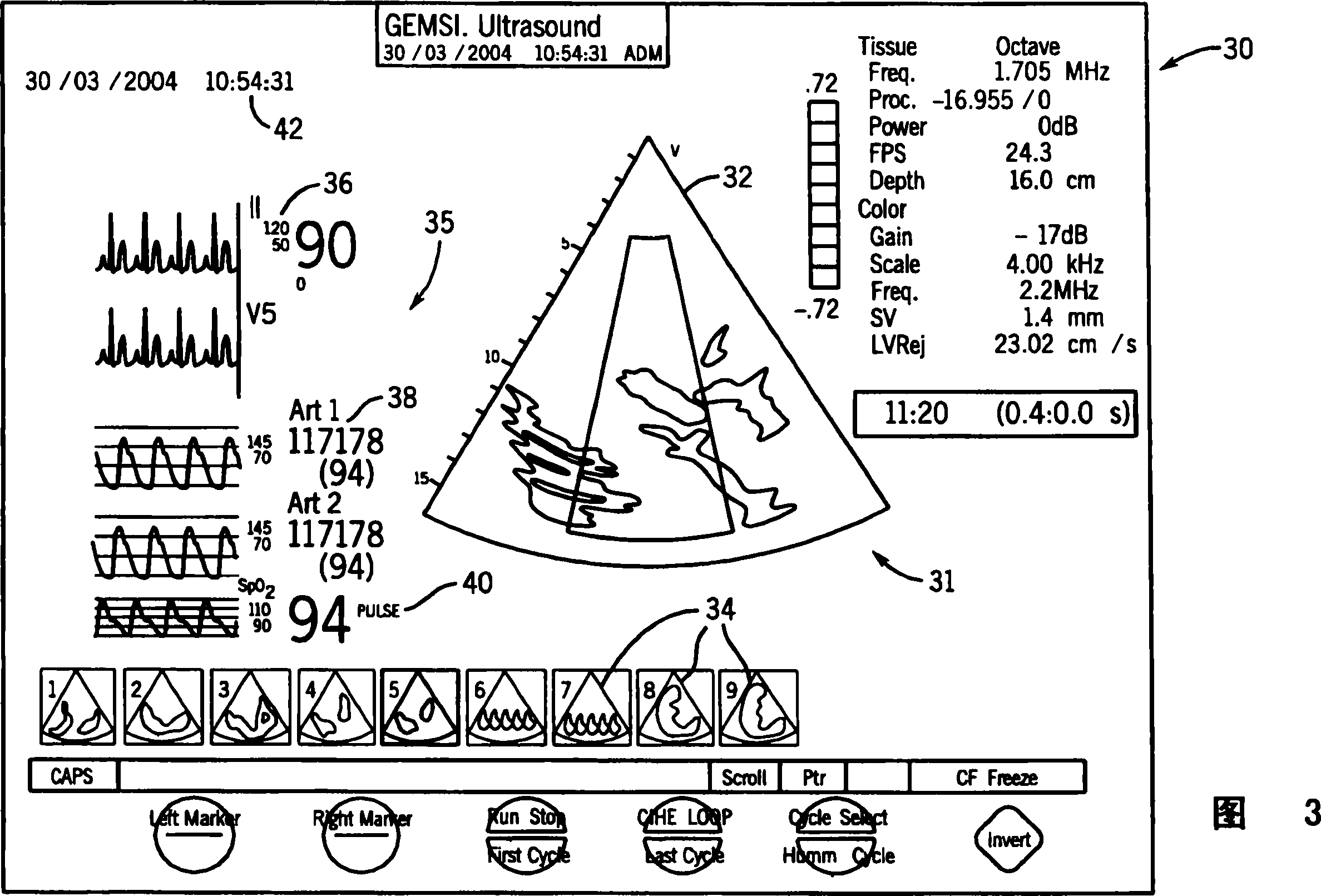 Integrated anesthesia monitoring and ultrasound display