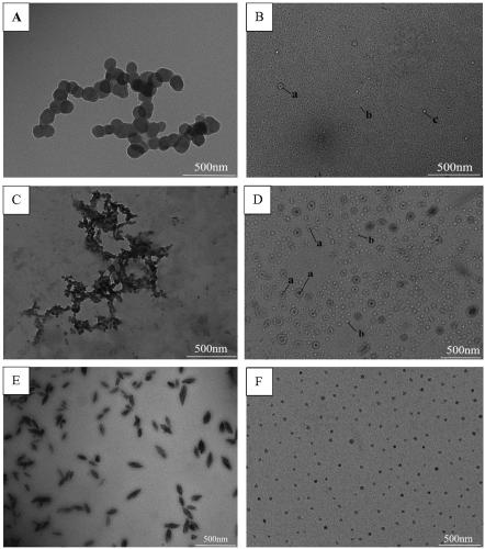 A kind of preparation method of shape and particle size controllable starch nanoparticles