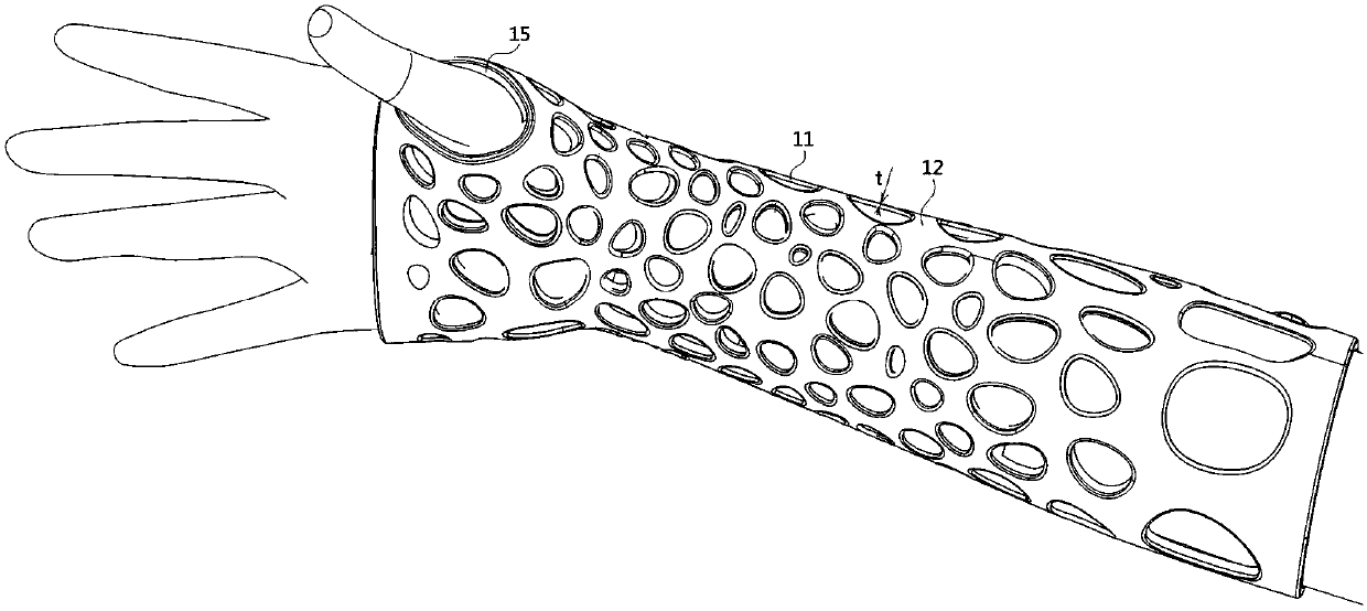 Adjustable outer fixing support and its material formula, preparation method and use method